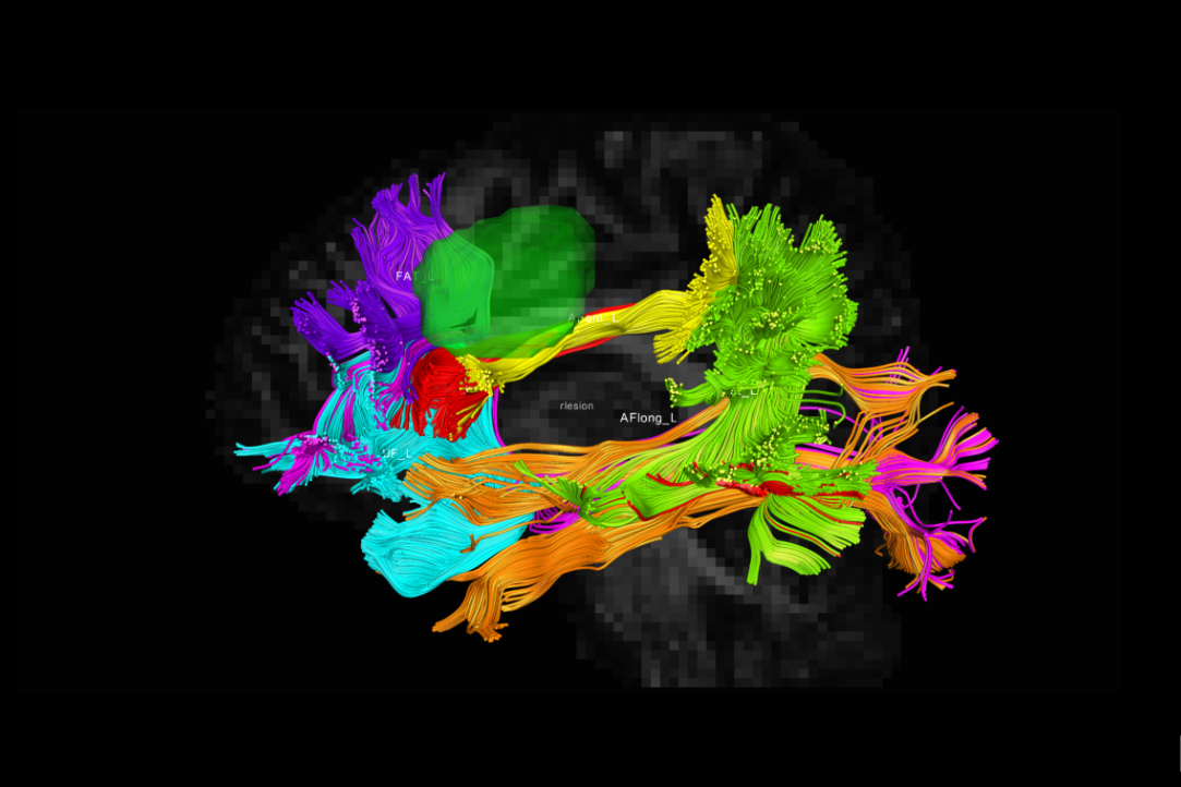 practical course on diffusion-tensor tractography at the Center for Language and Brain