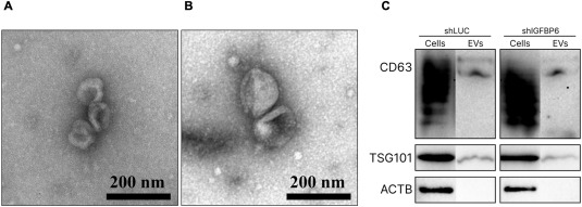 Электронная микрофотография экзосом и вестерн-блот маркерных белков 